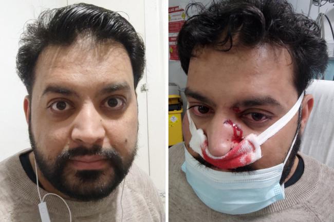 Mansoor Ahmad was the victim of a racist attack by one of his customers