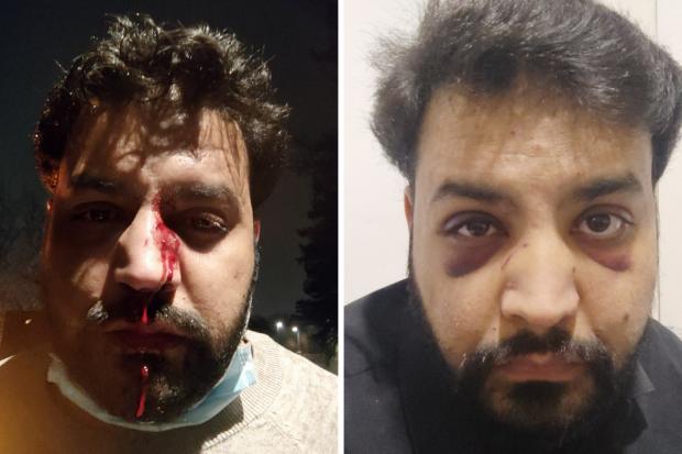 Asian Image: Mansoor Ahmad just after the attack and yesterday