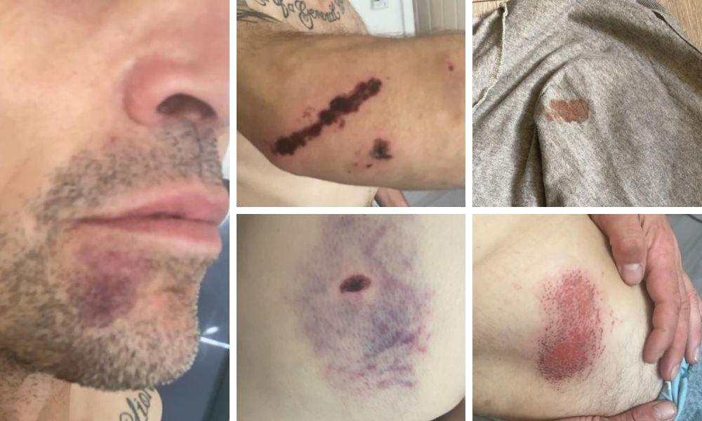 ‘I’m going to die’ – Man says he’s leaving metropolis after ‘unprovoked’ gang assault