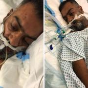 Asam Iqbal, a dad of four from Keighley, pictured during his treatment in ICU at Airedale Hospital