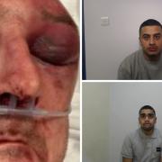 James Turner was savagely beaten by Zain Azim, top and Hashikesh Patel, bottom